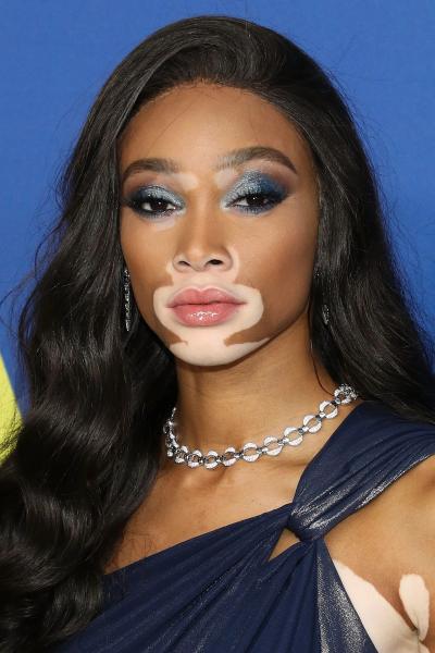 Photo de Winnie Harlow